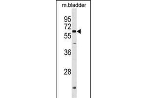 PGM2L1 Antibody (C-term) (ABIN1537400 and ABIN2849741) western blot analysis in mouse bladder tissue lysates (35 μg/lane).