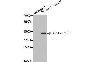 Western Blotting (WB) image for anti-Signal Transducer and Activator of Transcription 5A (STAT5A) (pTyr694) antibody (ABIN1870647) (STAT5A antibody  (pTyr694))