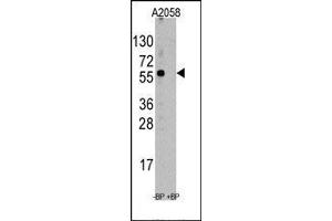 Image no. 1 for anti-Suppression of Tumorigenicity 13 (ST13) (N-Term) antibody (ABIN358737) (HSC70 Interacting Protein HIP antibody  (N-Term))
