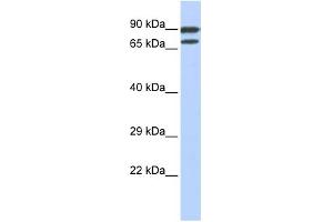 WB Suggested Anti-ZNF583 Antibody Titration:  0.