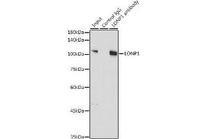 Immunoprecipitation analysis of 300 μg extracts of A-549 cells using 3 μg LONP1 antibody (ABIN1680707, ABIN3018785, ABIN3018786 and ABIN6220576). (LONP1 antibody  (AA 120-400))