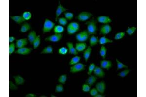 Immunofluorescence staining of Hela cells with ABIN7175695 at 1:66, counter-stained with DAPI. (WDFY2 antibody  (AA 2-114))
