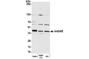 anti-alpha- and gamma-Adaptin Binding Protein (AAGAB) (AA 265-315) antibody