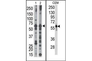 Image no. 1 for anti-6-phosphofructo-2-Kinase/fructose-2,6-Biphosphatase 3 (PFKFB3) (C-Term) antibody (ABIN360653) (PFKFB3 antibody  (C-Term))