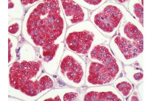 Immunohistochemistry (IHC) image for anti-Purinergic Receptor P2Y, G-Protein Coupled, 1 (P2RY1) (C-Term) antibody (ABIN1049199)