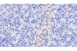 Detection of GIP in Human Pancreas Tissue using Monoclonal Antibody to Gastric Inhibitory Polypeptide (GIP) (GIP antibody)