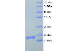 SDS-PAGE (SDS) image for SET Domain and Mariner Transposase Fusion Gene (SETMAR) (AA 1-118), (full length) protein (His tag) (ABIN4975637) (SETMAR Protein (AA 1-118, full length) (His tag))
