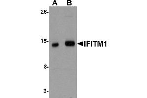Western Blotting (WB) image for anti-Interferon-Induced Transmembrane Protein 1 (IFITM1) (Middle Region) antibody (ABIN1030951) (IFITM1 antibody  (Middle Region))