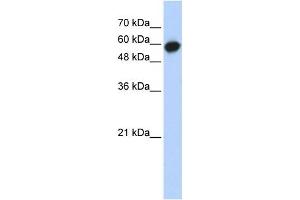 Western Blotting (WB) image for anti-Leucine Rich Repeat Containing 6 (LRRC6) antibody (ABIN2459700) (LRRC6 antibody)