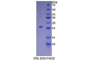 SDS-PAGE (SDS) image for Biglycan (BGN) (AA 49-182) protein (His tag) (ABIN1098894) (Biglycan Protein (BGN) (AA 49-182) (His tag))