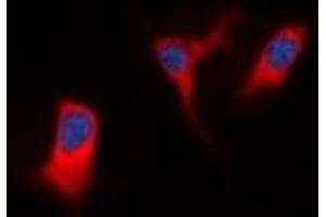 Immunofluorescent analysis of DAP Kinase 1 staining in K562 cells. (DAP Kinase 1 antibody)