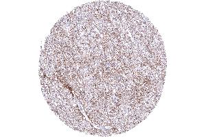 Cerebrum showing a moderate fibrillar GPM6A staining of nerve fibres