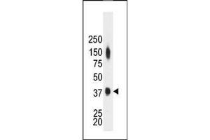 The anti-CKM Pab (ABIN391095 and ABIN2841234) is used in Western blot to detect CKM in mouse heart tissue lysate. (CKM antibody  (N-Term))