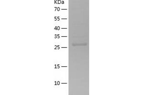 PIM1 Protein (AA 38-290) (His tag)