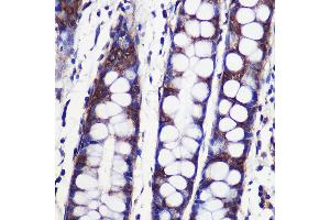 Immunohistochemistry of paraffin-embedded Human colon using SPPL2A Rabbit pAb (ABIN7270297) at dilution of 1:100 (40x lens). (SPPL2A antibody  (AA 421-520))