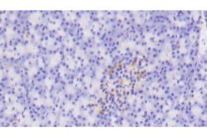 Detection of TLR5 in Human Pancreas Tissue using Polyclonal Antibody to Toll Like Receptor 5 (TLR5) (TLR5 antibody  (AA 303-514))