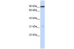WB Suggested Anti-CHRNA4 Antibody Titration:  0. (CHRNA4 antibody  (N-Term))