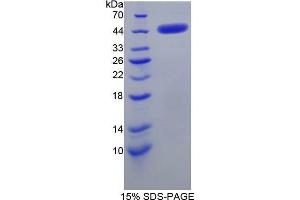 SDS-PAGE (SDS) image for Corticotropin Releasing Hormone (CRH) (AA 28-160) protein (His tag,GST tag) (ABIN2122707)