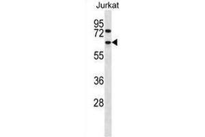 CCT4 Antibody (N-term) western blot analysis in Jurkat cell line lysates (35µg/lane).