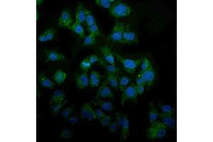 IF analysis of MAP3K8 using anti-MAP3K8 antibody (ABIN4886663). (MAP3K8 antibody  (AA 9-193))