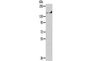 Gel: 6 % SDS-PAGE,Lysate: 40 μg,Primary antibody: ABIN7192352(SHANK1 Antibody) at dilution 1/200 dilution,Secondary antibody: Goat anti rabbit IgG at 1/8000 dilution,Exposure time: 1 minute (SHANK1 antibody)