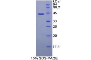 SDS-PAGE analysis of Mouse HYAL2 Protein. (HYAL2 Protein)