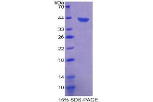 SDS-PAGE (SDS) image for Chemokine (C Motif) Ligand 1 (XCL1) (AA 23-113) protein (His tag,GST tag) (ABIN2123197)