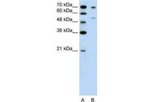 Western Blotting (WB) image for anti-Forkhead Box B2 (FOXB2) antibody (ABIN2462637)