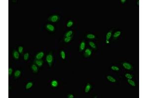 Immunofluorescent analysis of Hela cells using ABIN7159124 at dilution of 1:100 and Alexa Fluor 488-congugated AffiniPure Goat Anti-Rabbit IgG(H+L) (MED22 antibody  (AA 2-140))