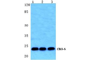 Western blot (WB) analysis of CD3-δ antibody at 1/500 dilution (CD3D antibody  (Chain delta))