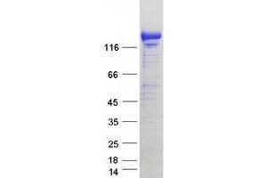 Validation with Western Blot (KIAA1468 Protein (KIAA1468) (Myc-DYKDDDDK Tag))