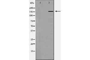 Western blot analysis of CUTL1 expression in K562 cells,The lane on the left is treated with the antigen-specific peptide. (CUX1 antibody  (N-Term))
