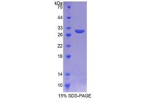 SDS-PAGE analysis of Mouse AGA Protein. (AGA Protein)