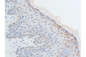 Immunohistochemistry (IHC) image for anti-Checkpoint Kinase 2 (CHEK2) (pThr387) antibody (ABIN6256554)