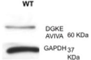 DGKE antibody - N-terminal region  validated by WB using lymph at 1:1000.
