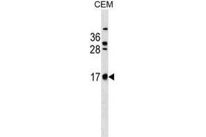 C Antibody (C-term) (ABIN1536654 and ABIN2849825) western blot analysis in CEM cell line lysates (35 μg/lane). (C2ORF83 antibody  (C-Term))