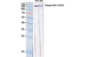 Western Blot (WB) analysis of specific cells using Phospho-IRS-1 (S307) Polyclonal Antibody.