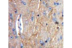 IHC-P analysis of Brain tissue, with DAB staining. (C1QA antibody  (AA 23-245))