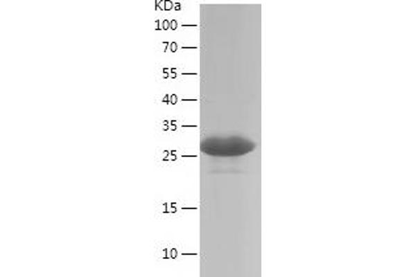 ETV5 Protein (AA 1-200) (His tag)