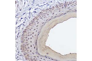 Immunohistochemistry of paraffin-embedded Mouse skin using SSC/SerpinB3 Rabbit mAb (ABIN7270242) at dilution of 1:100 (40x lens). (SERPINB3 antibody)