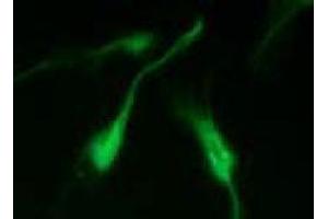Immunofluorescence (IF) image for anti-Vimentin (VIM) (pSer50) antibody (ABIN1449160) (Vimentin antibody  (pSer50))