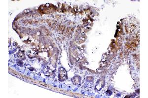 IHC analysis of Factor D using anti-Factor D antibody . (Adipsin antibody  (AA 26-253))