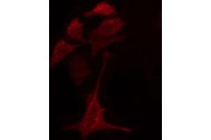 ABIN6274776 staining A549 cells by IF/ICC. (RPL28 antibody)