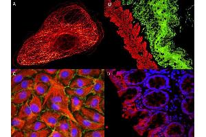 Immunofluorescence (IF) image for Rabbit anti-Mouse IgG antibody (Atto 550) - Preadsorbed (ABIN1043989) (Rabbit anti-Mouse IgG Antibody (Atto 550) - Preadsorbed)