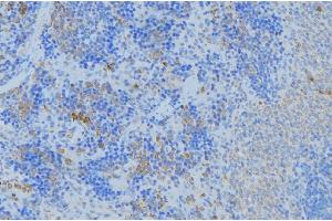 ABIN6277157 at 1/100 staining Human lymph node tissue by IHC-P. (KRT17 antibody  (C-Term))