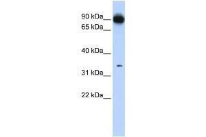 WB Suggested Anti-PRKRA Antibody Titration: 0. (PRKRA antibody  (N-Term))