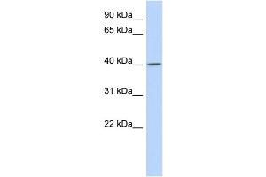 WB Suggested Anti-C11orf65 Antibody Titration: 0. (C11orf65 antibody  (N-Term))