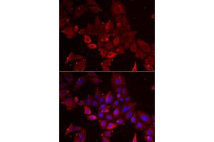 Immunofluorescence analysis of U2OS cells using MYOT antibody (ABIN5973839). (Myotilin antibody)