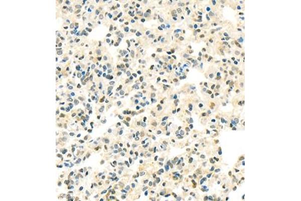 PTMA antibody