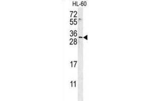 Western Blotting (WB) image for anti-Empty Spiracles Homeobox 2 (EMX2) antibody (ABIN3002378) (EMX2 antibody)